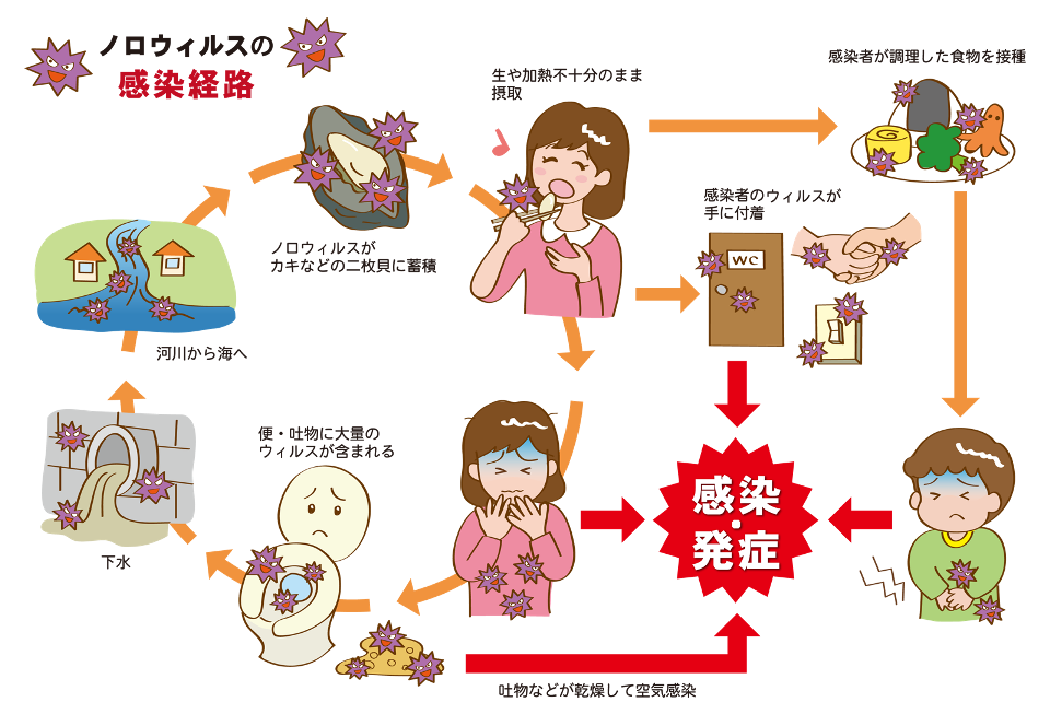 症状 ノロウイルス ノロウイルス感染症とは
