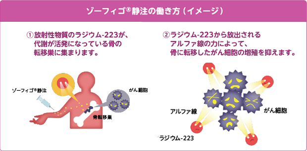 ｿﾞｰﾌｨｺﾞ静注