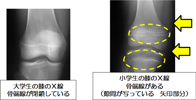 き ぼ ね が 折れる