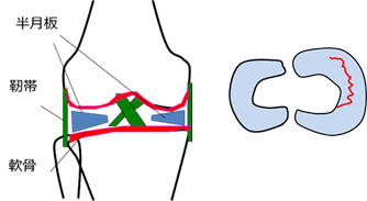 膝のスポーツ障害 社会医療法人 若弘会 若草第一病院 大阪府東大阪市